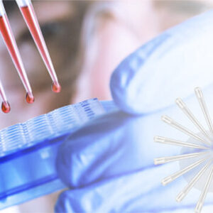 Sterile Pipette Tips 1000µL — 96 Rack